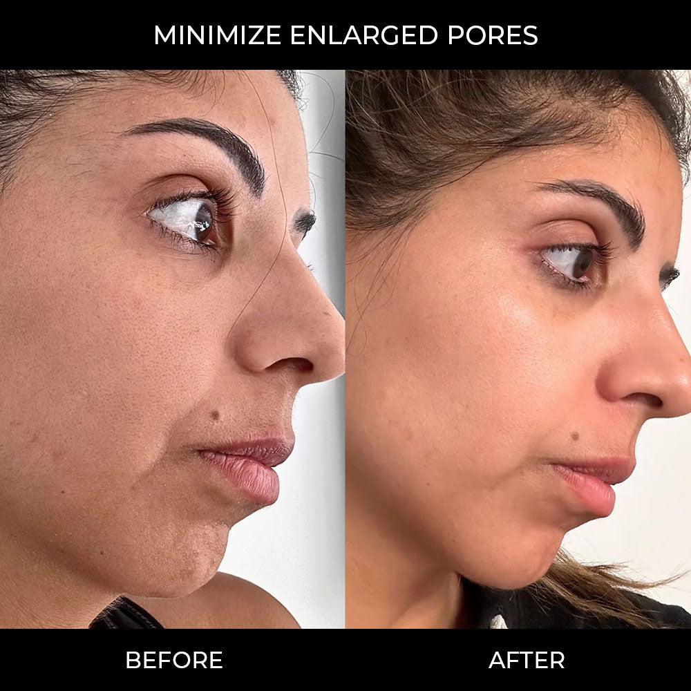 PDRN Pink Collagen Gel Mask