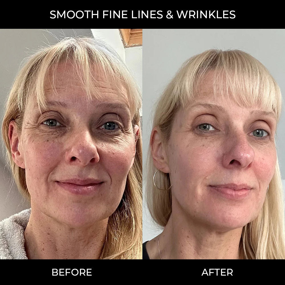 PDRN Pink Collagen Gel Mask