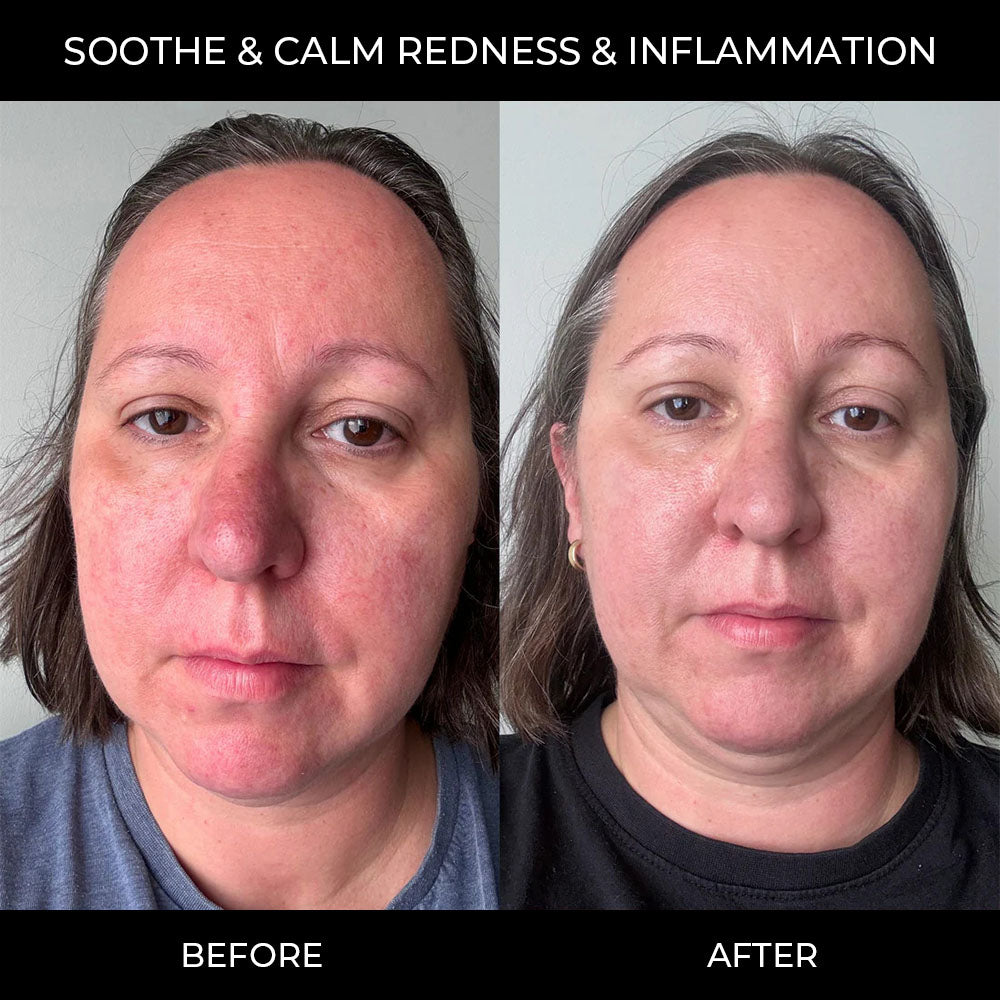 PDRN Pink Collagen Gel Mask