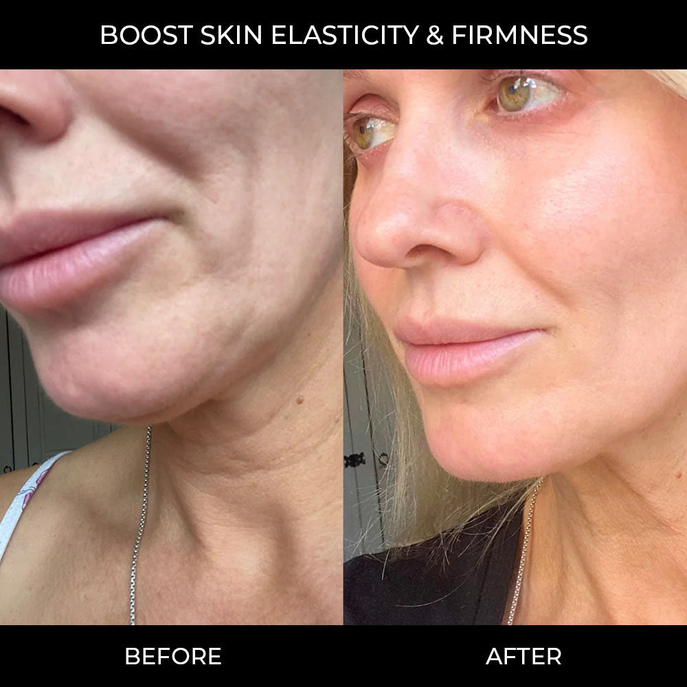 PDRN Pink Collagen Gel Mask