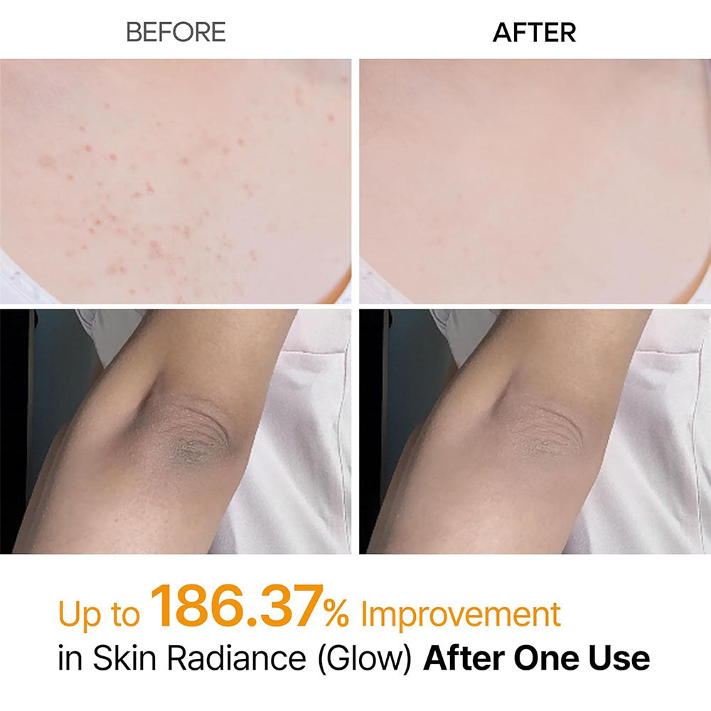 Kojic Acid & Turmeric Brightening Spray