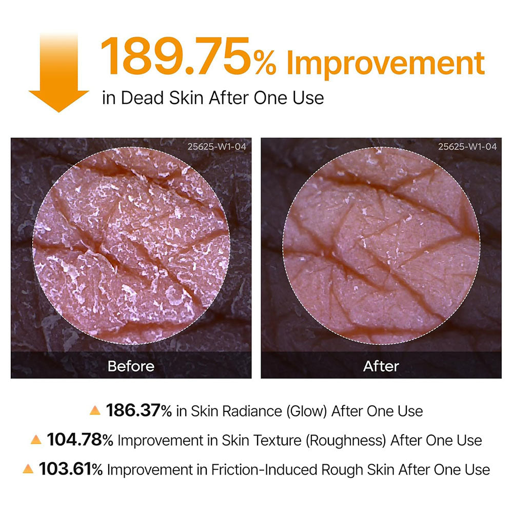 Kojic Acid & Turmeric Brightening Spray