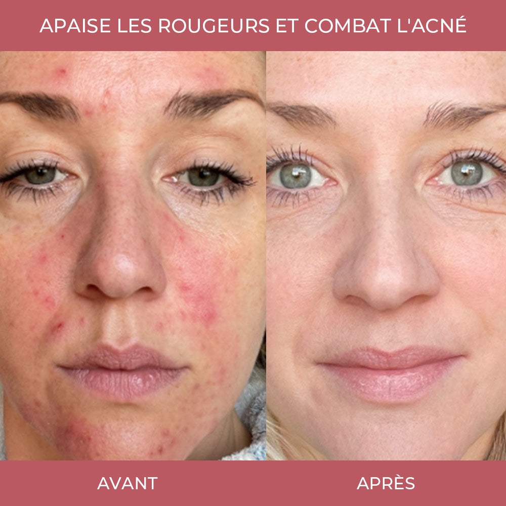 Masque au collagène PDRN