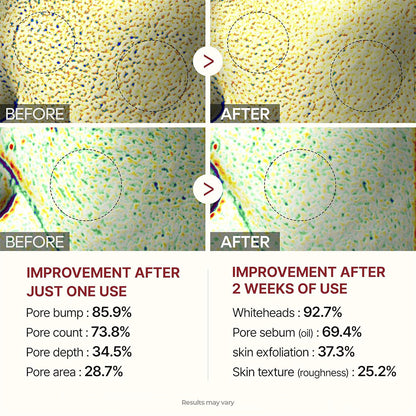 Peel Shot Glow Rice Ampoule Duo