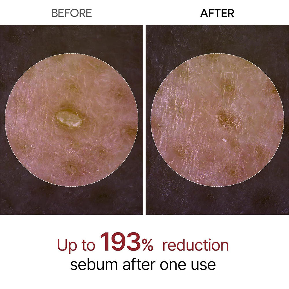 Peel Shot Glow Rice Ampoule Duo